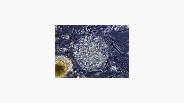 20x zvětšený pohled na kmenové buňky