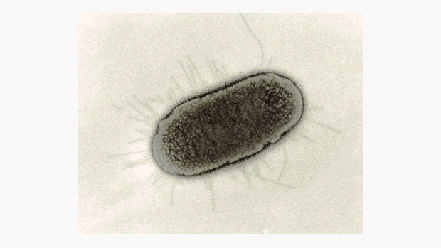 Bakterie E. coli