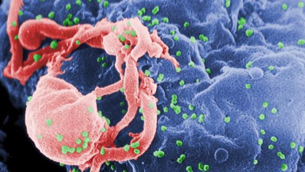 Viry HIV pučící z bílé krvinky