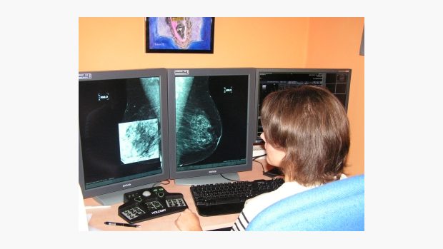 Digitální mamograf
