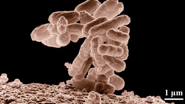Kolonie Escherichia coli při 10000násobném zvětšení elektronovým mikroskopem