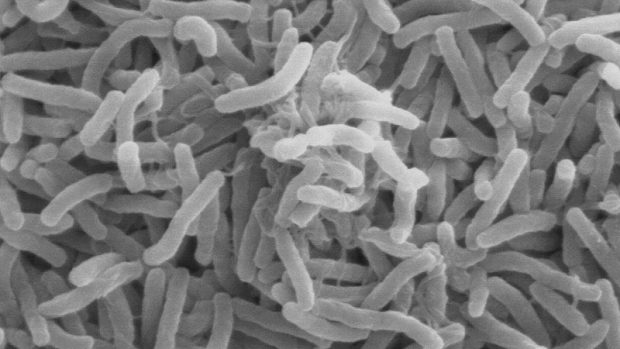Bakterie cholery pod mikroskopem