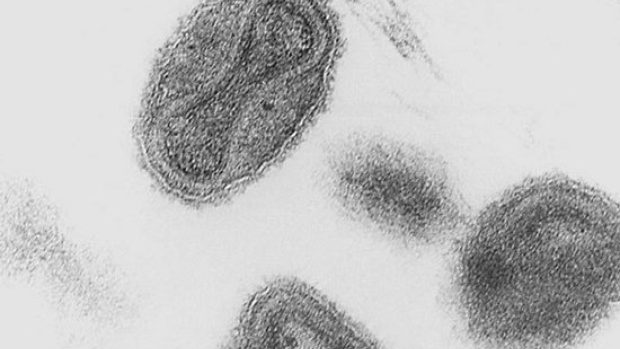 Viriony neštovic zobrazené elektronovým mikroskopem