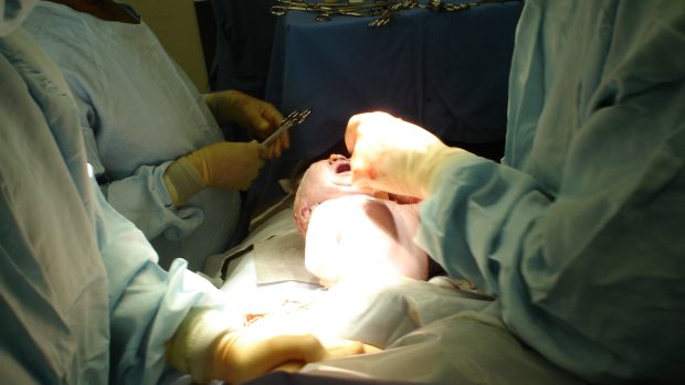 Porod jakom operace