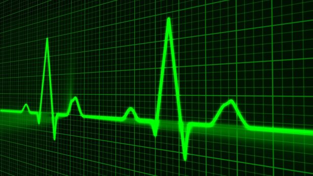 EKG, lidský puls, srdce, nemoc, zdavotnictví