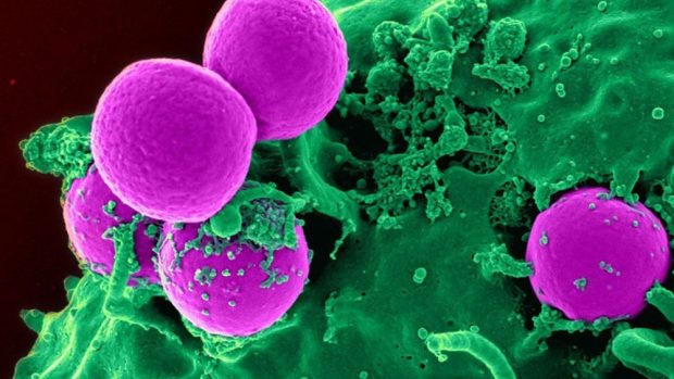 Lékaře znepokojují bakterie odolné vůči nejsilnějším antibiotikům (ilustrační foto)