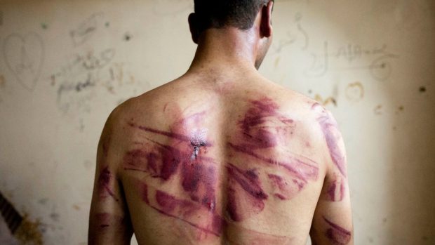 Syřan ukazuje stopy po mučení, které nese na zádech po propuštění z režimem spravovaného vězení (severní Aleppo, 23. srpna 2012).